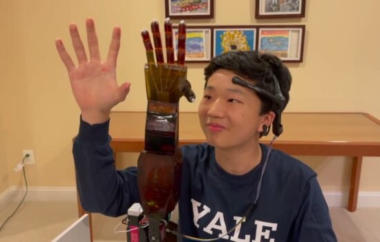 Школяр створив протез руки котрий керується думками